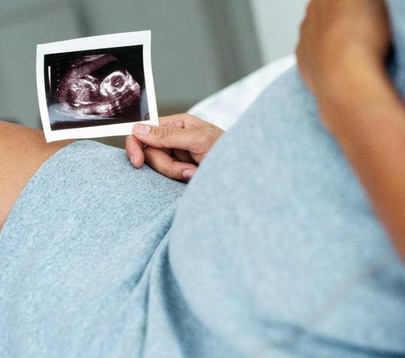 Nėščios moters echoskopija